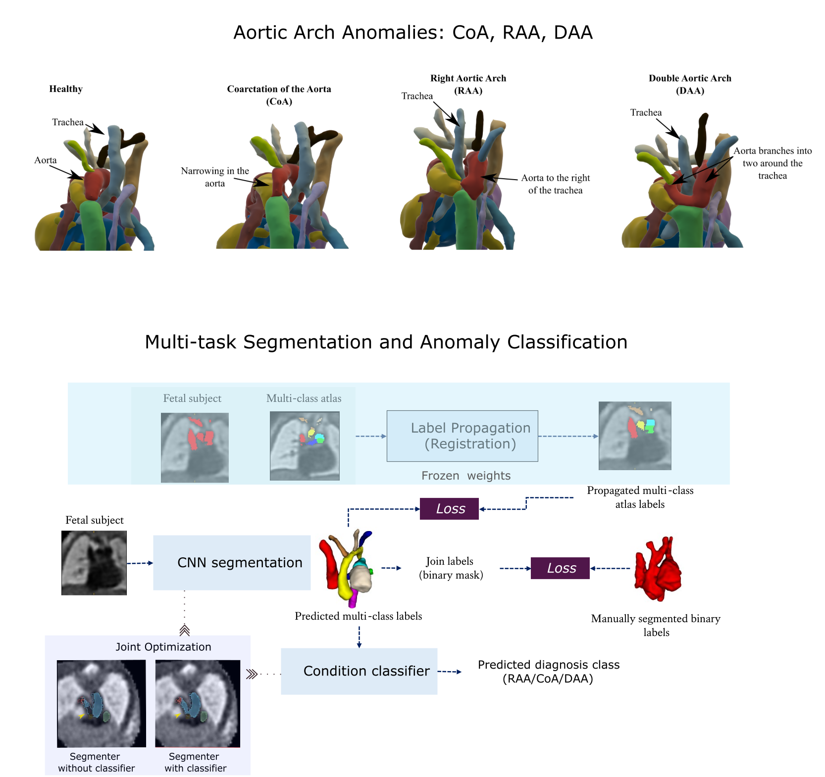 3D Fetal MRI cardiac vessel segmentation