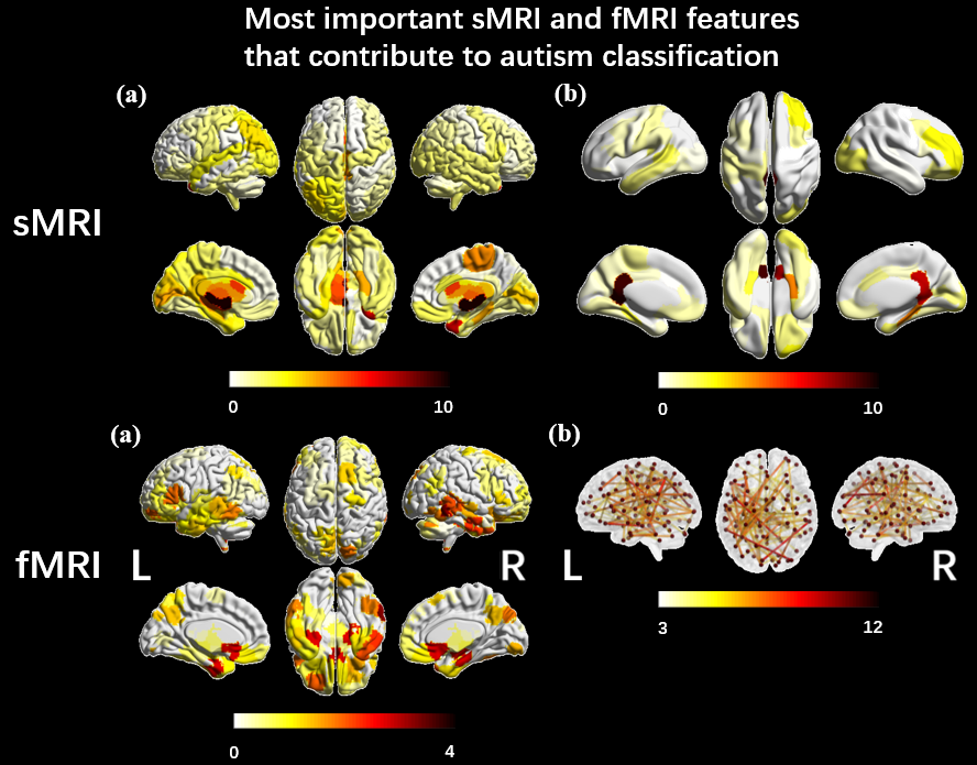 Reproducible comparison and interpretation of machine learning classifiers to predict autism on the ABIDE multimodal dataset