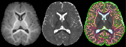 Segmentation of 6 months old babies