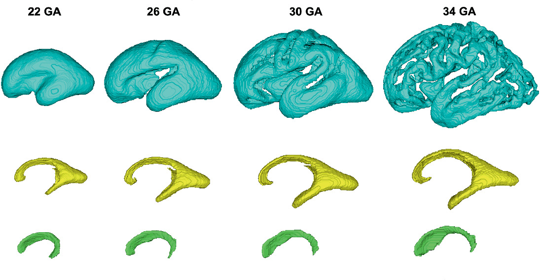 A Deep Learning Approach for Segmenting the Subplate and Proliferative Zones in Fetal Brain MRI