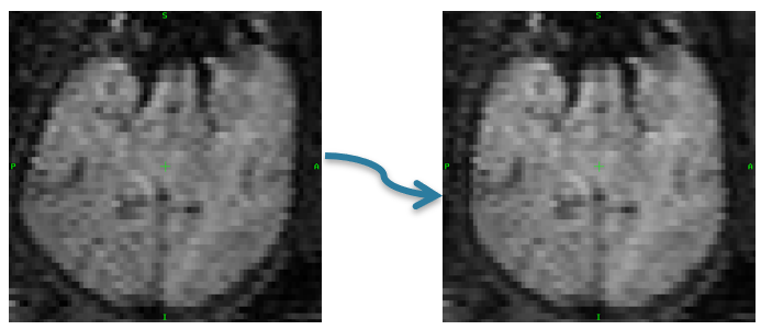 Distortion Correction in Fetal EPI Using Non-Rigid Registration With a Laplacian Constraint