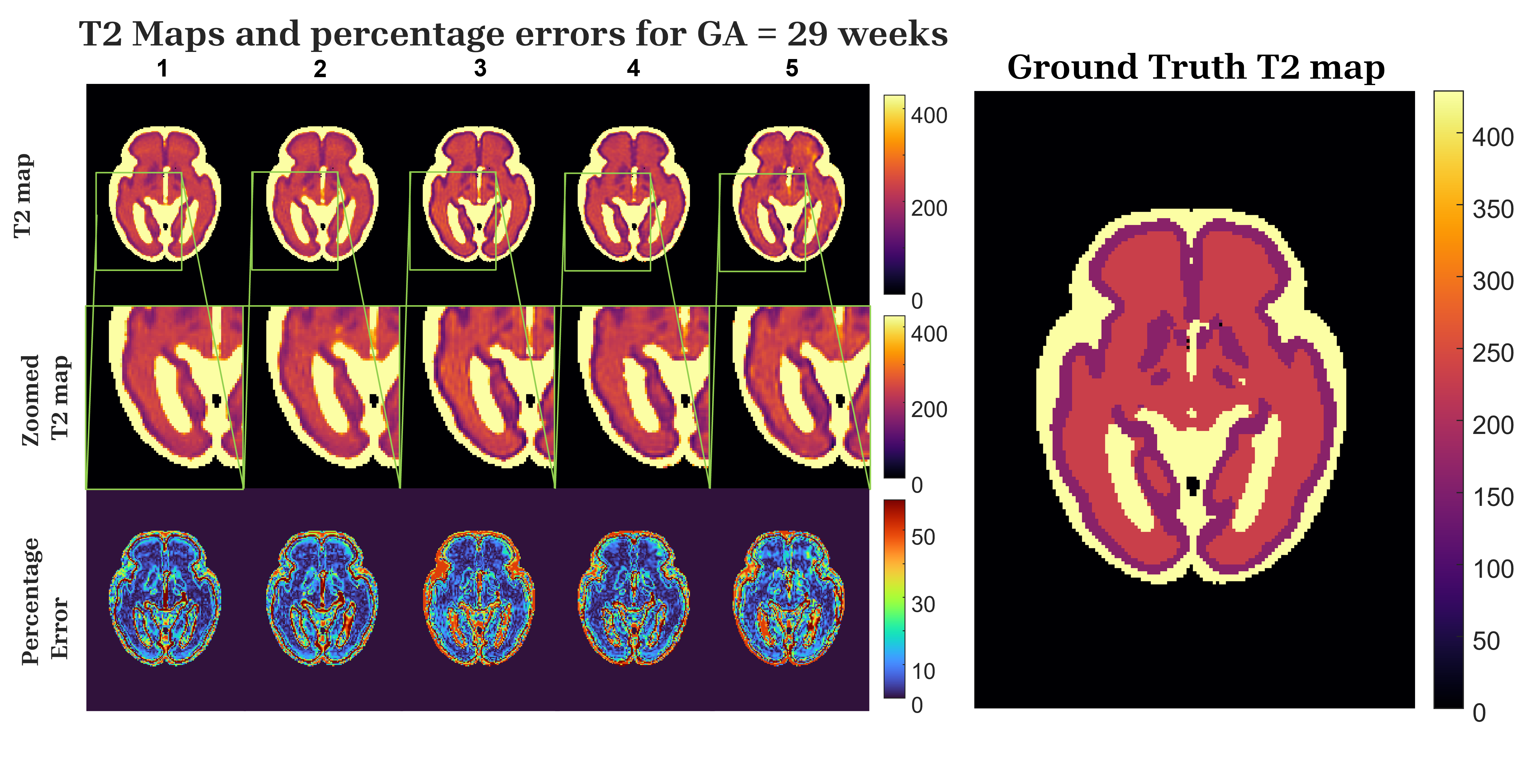 Quantitative T2 Relaxometry in Fetal Brain: Validation Using Modified FaBiaN Fetal Brain MRI Simulator