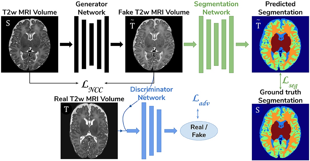 Harmonised segmentation of neonatal brain MRI